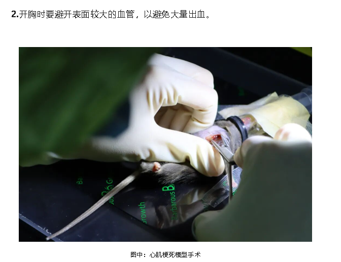 心肌2